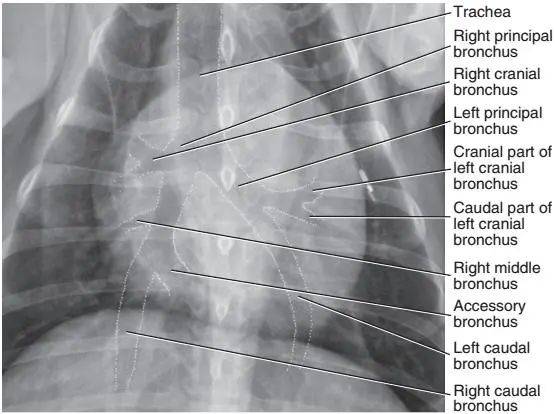 九张标准X线片带你快速了解气管支气管结构-实验室文章基地